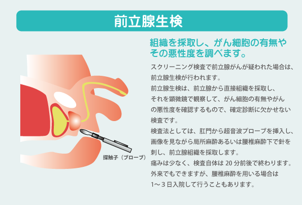 前立腺生検